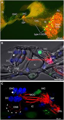 Noise-induced hearing loss vulnerability in type III intermediate filament peripherin gene knockout mice